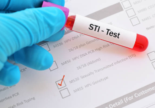 Ano ang mga Sakit na STD o Sexually Transmitted Infections (STI)